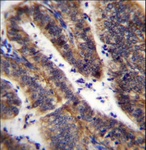 LRRN4CL Antibody (aa117-146)