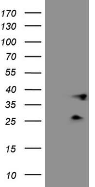 PLCXD1 Antibody (clone OTI9D4)