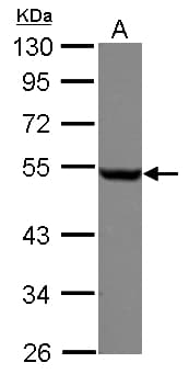 TUBB / Beta Tubulin Antibody