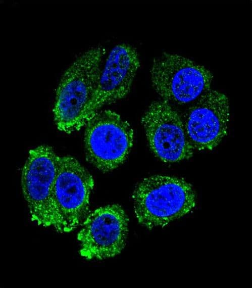 Polyclonal Rabbit anti-Human RARS Antibody (aa605-634, IHC, IF, WB)