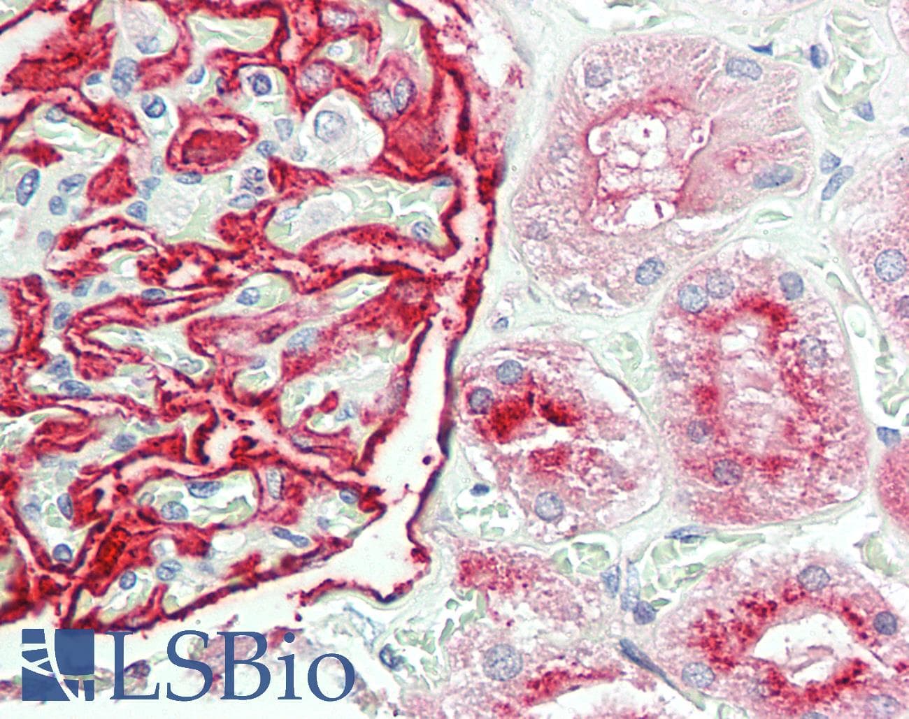 ENPEP / Aminopeptidase A Antibody (HRP)