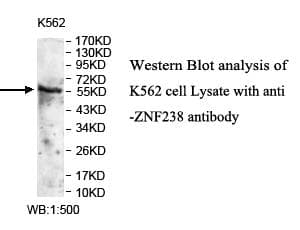 Polyclonal Rabbit anti-Human ZNF238 Antibody (aa228-498, WB)