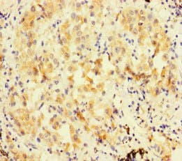 FBXL21 Antibody