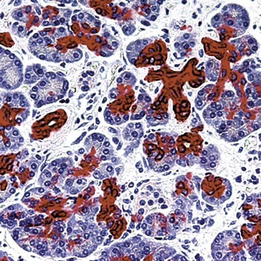 KRT7 / CK7 / Cytokeratin 7 Antibody (clone OV-TL 12/30)
