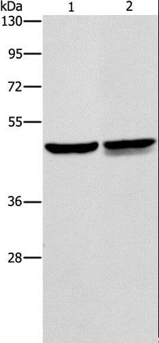 AMACR / P504S Antibody