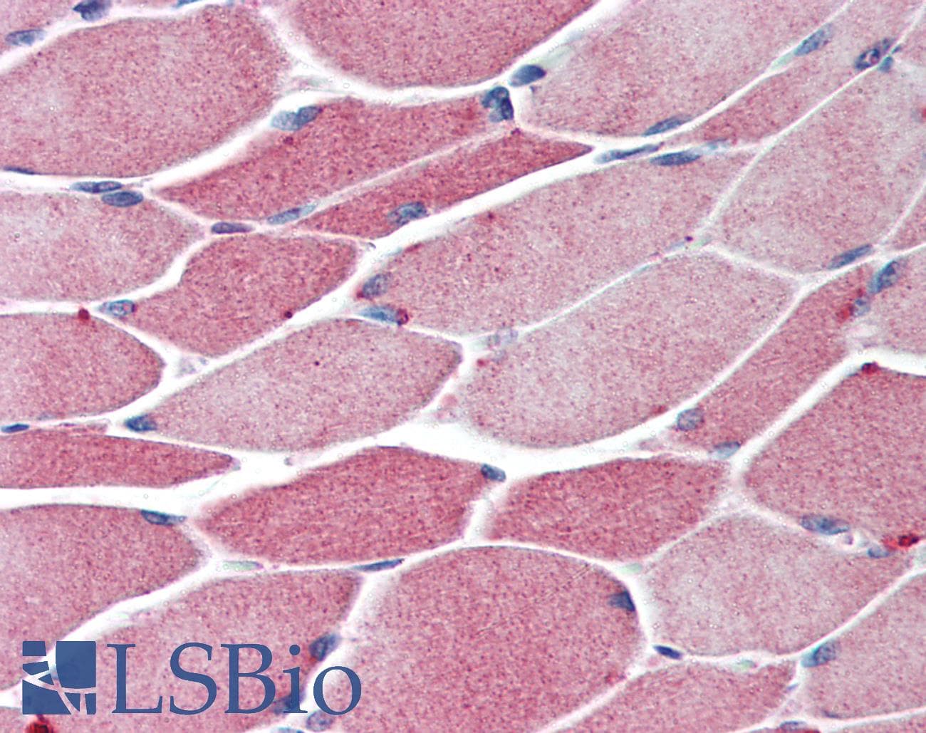 IHC-plus™ BACH1 Antibody