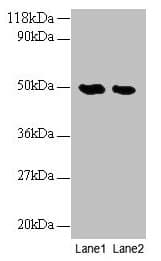 NGB / Neuroglobin Antibody