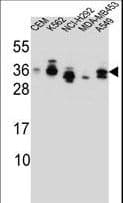 SSX4 Antibody (aa63-91)