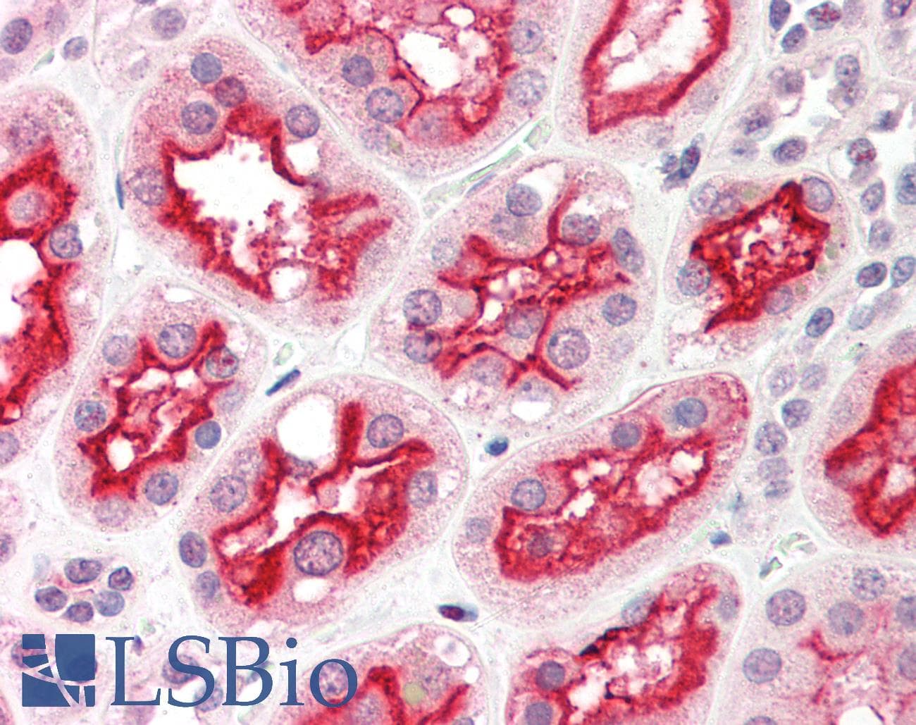 PathPlus™ Polyclonal Rabbit anti-Human ACE2 / ACE-2 Antibody (IHC, IF, WB)