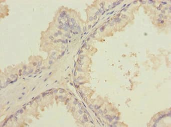 LMO4 Antibody