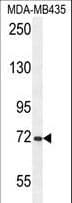 ARHGAP10 Antibody (aa237-263)
