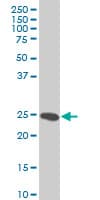 IHC-plus™ HMG2 / HMGB2 Antibody (clone 3C7)