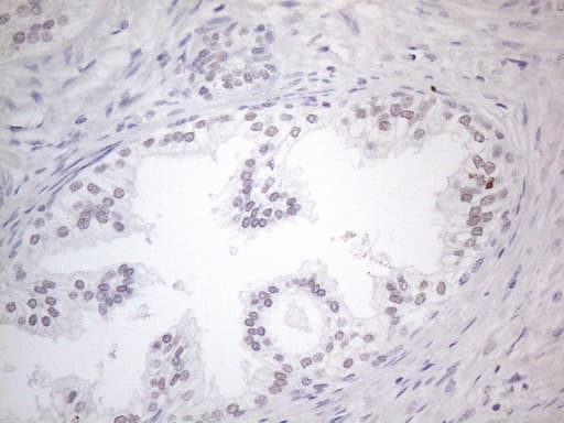 TDG / Thymine DNA Glycosylase Antibody (aa160-253, clone OTI3C11)