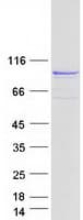 Human ADAR2 / ADARB1 Protein (Recombinant Myc-DDK (Flag))