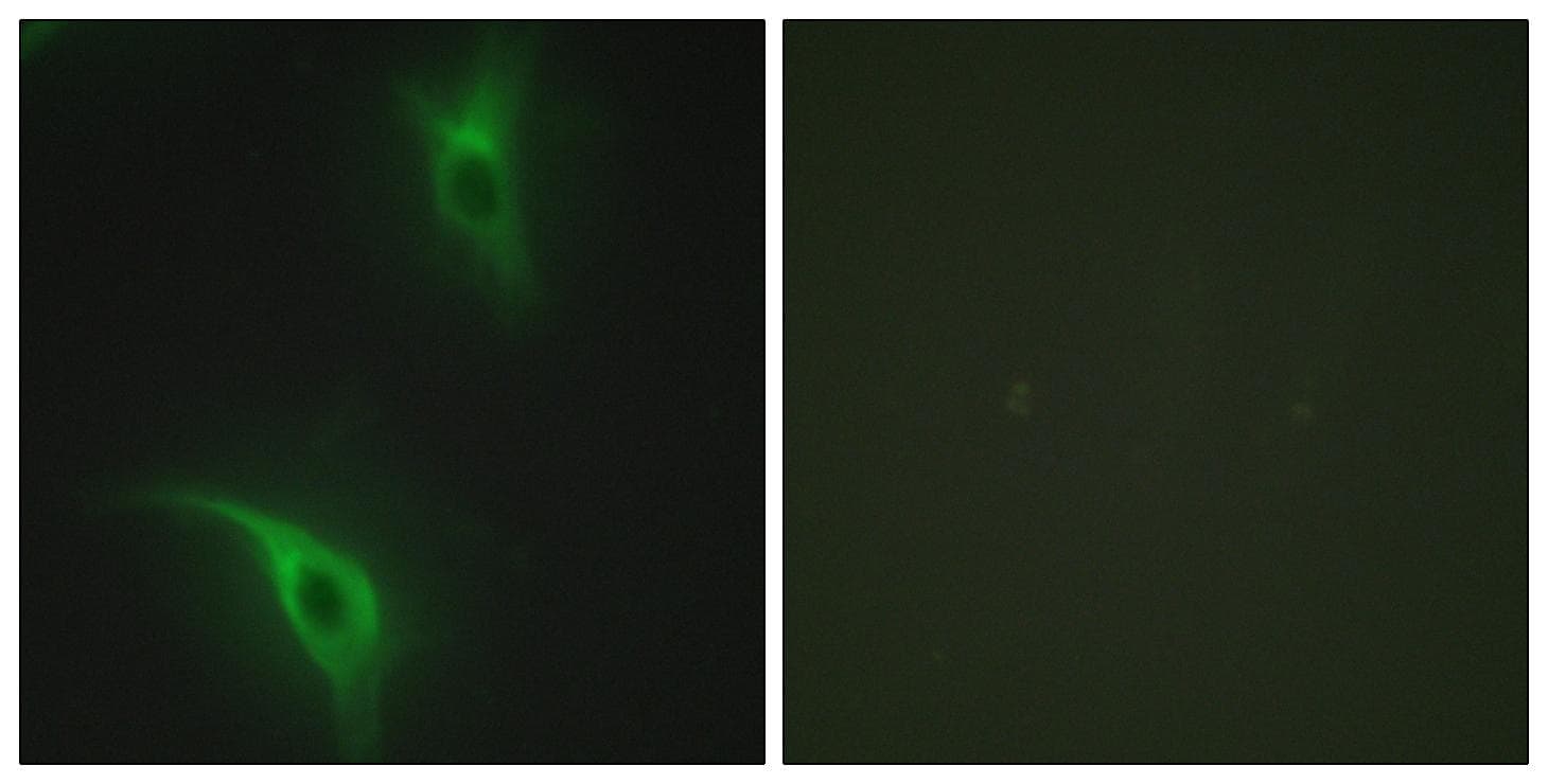 Polyclonal Rabbit anti-Human CKS1B / CKS1 Antibody (IF, WB)