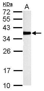 Polyclonal Rabbit anti-Human Rhodanese / TST Antibody (aa1-270, IHC, WB)