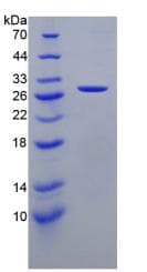 Human CTSK / Cathepsin K Protein (Recombinant His-T7)
