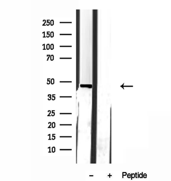 GDI2 Antibody
