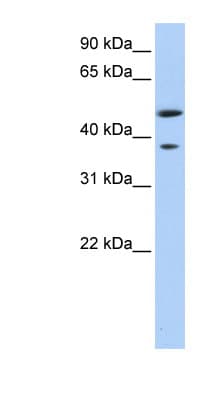 MAGEA3 Antibody (aa216-265, FITC)