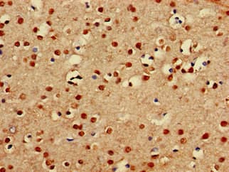 Polyclonal Rabbit anti-Human PRDM16 Antibody (IHC, IF)