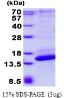 Human SH3BGRL2 Protein (Recombinant His)