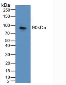 CDH16 / Cadherin 16 Antibody (aa37-287)