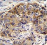 GSR / Glutathione Reductase Antibody (aa380-408)