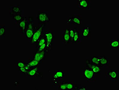 MSH6 Antibody (aa1-400)