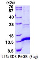 Human CISD1 Protein (Recombinant His)