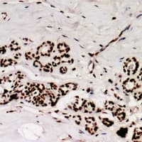SRSF9 / SFRS9 Antibody