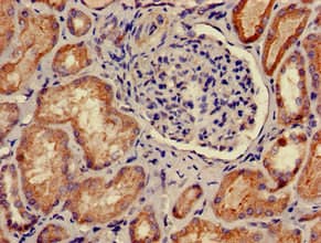 Polyclonal Rabbit anti-Human PRKACB Antibody (IHC, IF, WB)