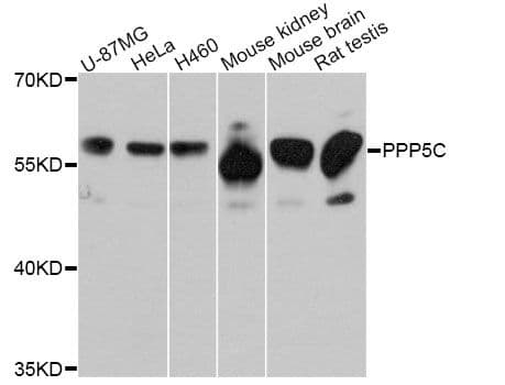 PPP5C Antibody