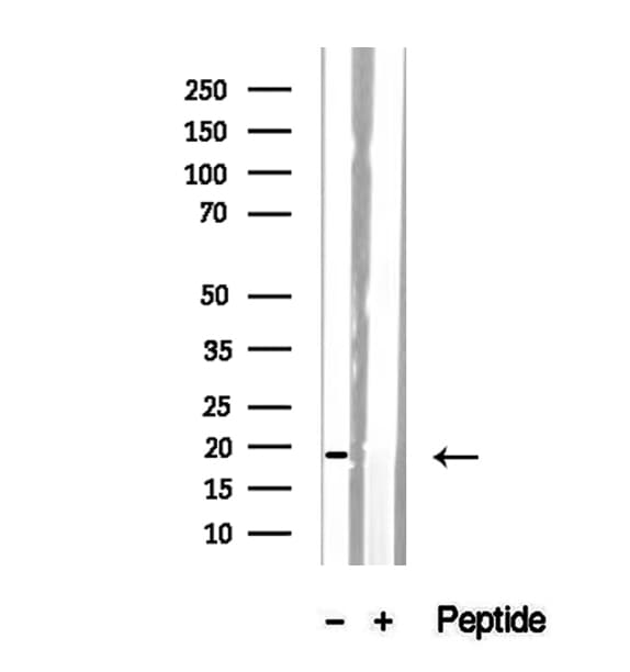Polyclonal Rabbit anti-Human SRP14 Antibody (IHC, IF, WB)