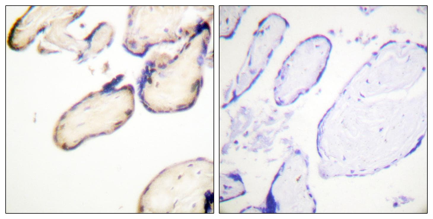HRS / HGS Antibody (phospho-Tyr334)