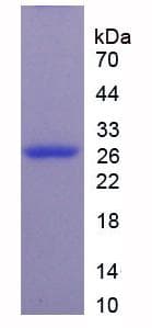Mouse MAP4 Protein (Recombinant His, N-Terminal)