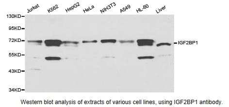 Polyclonal Rabbit anti-Human CRD-BP / ZBP1 / IGF2BP1 Antibody (IHC, WB)