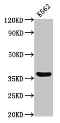 Polyclonal Rabbit anti-Human GPR12 Antibody (IHC, WB)