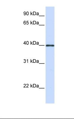 PathPlus™ GP2 Antibody (aa182-231)