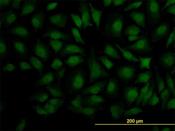 Monoclonal Mouse anti-Human DCPS Antibody (clone 1G4, IHC, IF, WB)