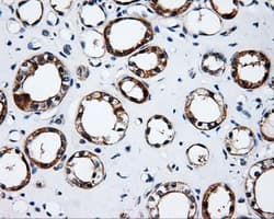 SRR / Serine Racemase Antibody (clone OTI1D7)