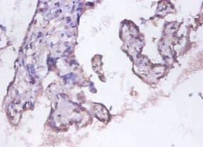 PSMD11 Antibody