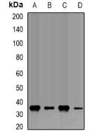 FBL / FIB / Fibrillarin Antibody