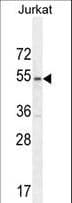 Polyclonal Rabbit anti-Human MPP1 Antibody (aa301-327, IHC, WB)