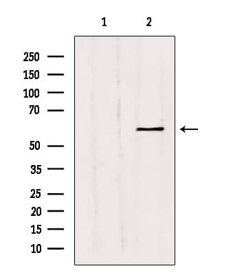 MMP11 Antibody