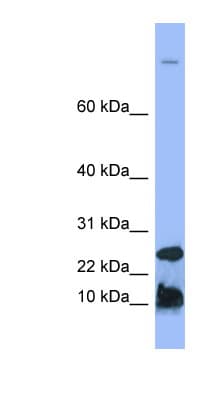 HAMP / Hepcidin Antibody (N-Terminus)