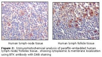 Monoclonal Mouse anti-Human BTK Antibody (clone 7F12H4, IHC, IF, WB)
