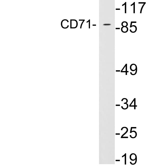 CD71 / Transferrin Receptor Antibody (aa14-63)