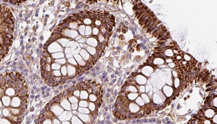 CISD1 Antibody