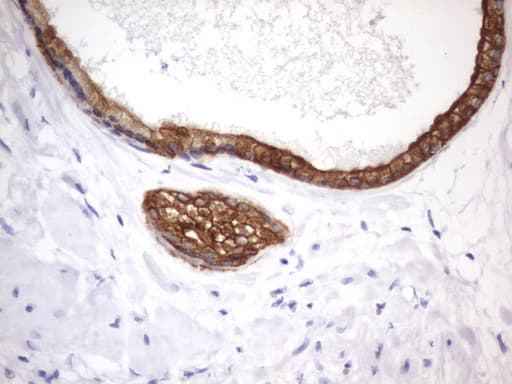 Acidic Cytokeratin Antibody (clone 8F5)