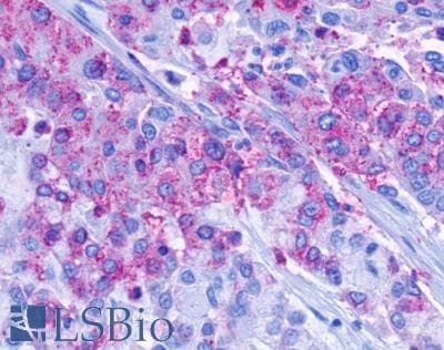 PathPlus™ FPR2 / FPRL1 Antibody (C-Terminus)